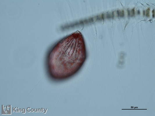 Photo of Gyrodinium spp.